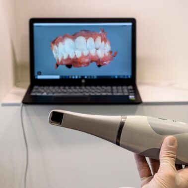 Centro Dentistico New Dental - Scanner Intraorale